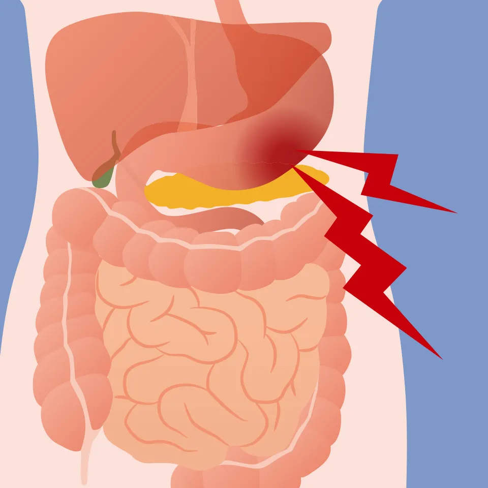 How stomach pain that comes and goes in waves